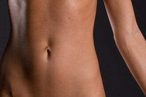 liposuction