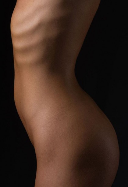 Liposuction for Back Fat in Englewood - Top Plastic Surgeon New