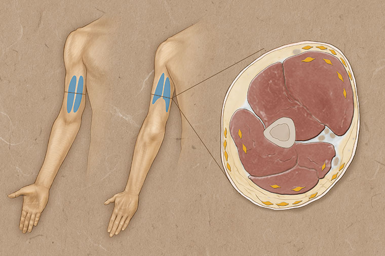 Biceps-Triceps-r2-web