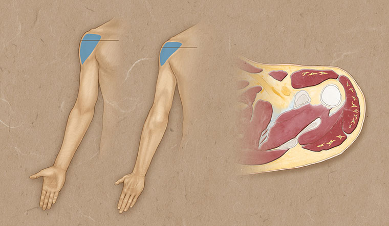 Deltoid-web