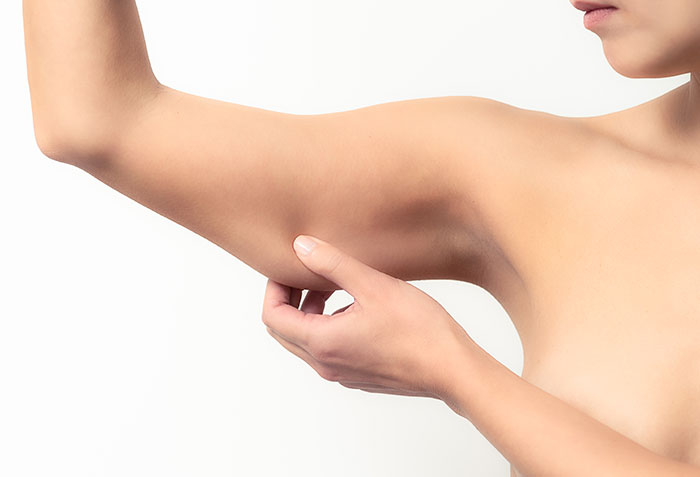 arm liposuction procedure