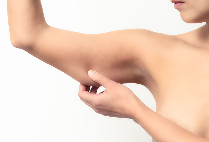 What Options Are There To Remove Arm Flab in Denver?