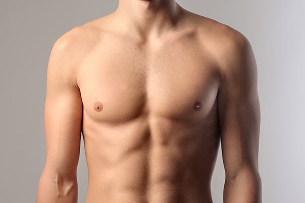 Is this gynecomastia? Please look closely and you will see my left